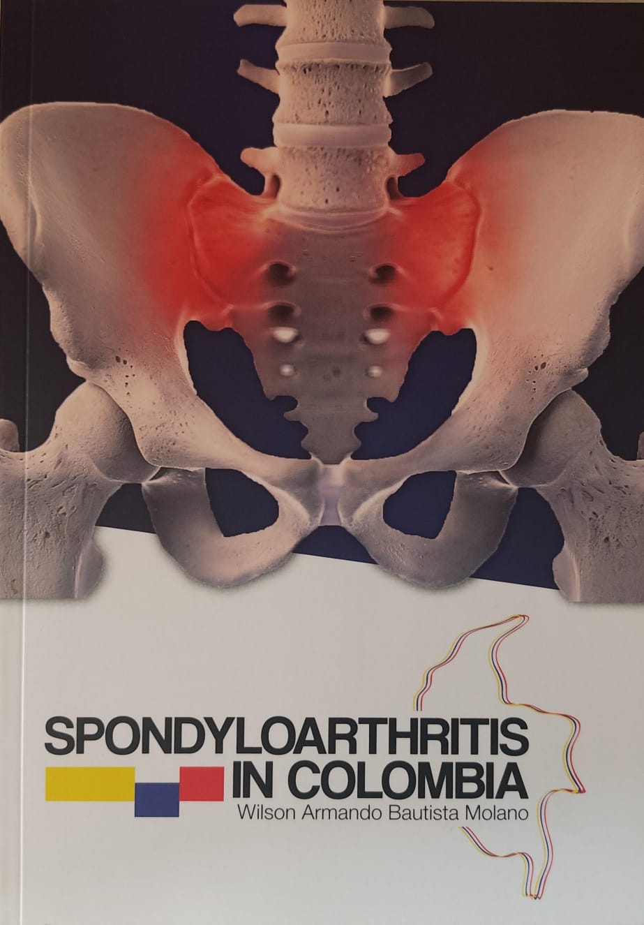 Portada del libro Spondyloarthritis in Colombia, por Wilson Armando Bautista Molano
